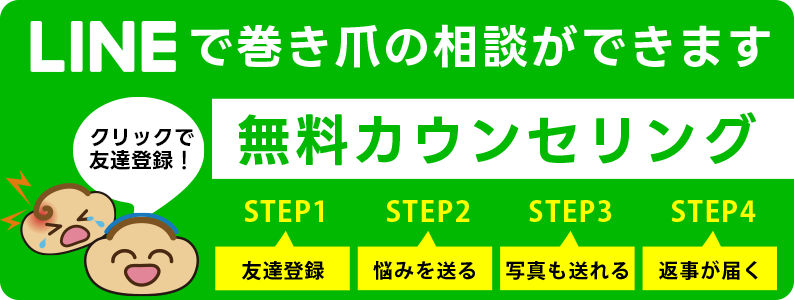 森田巻き爪センターへLINEで無料相談